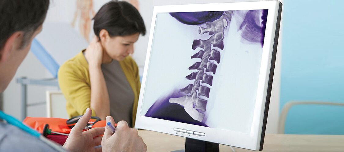 Osteochondrosis tulang belakang serviks