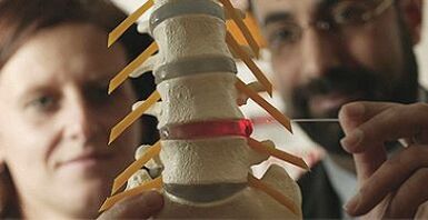 Pemeriksaan osteochondrosis pada model tulang belakang