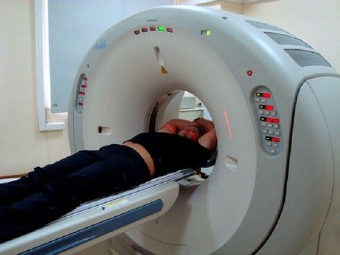 Diagnostik MRI untuk sakit belakang