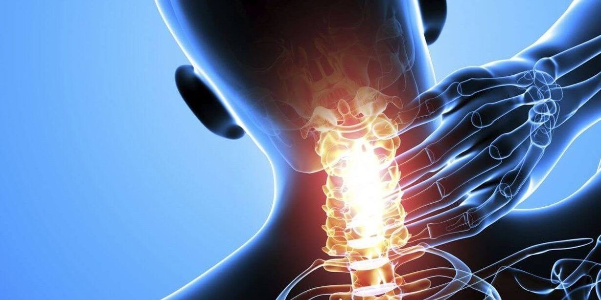 Sakit leher akibat osteochondrosis