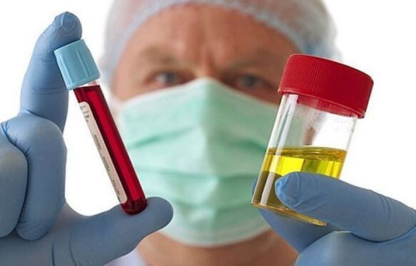 Peluang untuk mendiagnosis osteochondrosis tulang belakang serviks