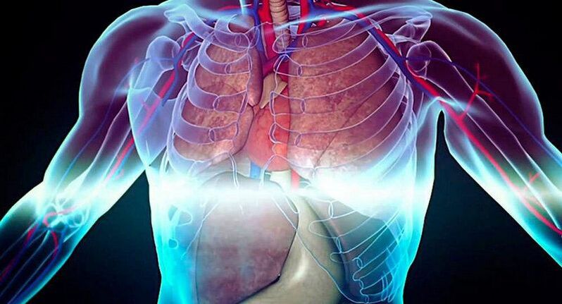 Neuralgia interkostal